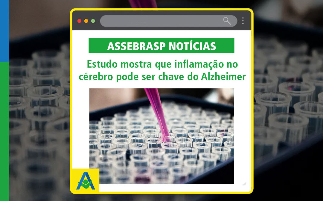 Estudo mostra que inflamação no cérebro pode ser chave do Alzheimer