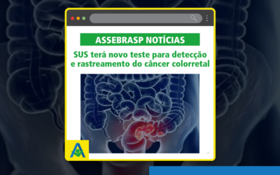 SUS terá novo teste para detecção e rastreamento do câncer colorretal