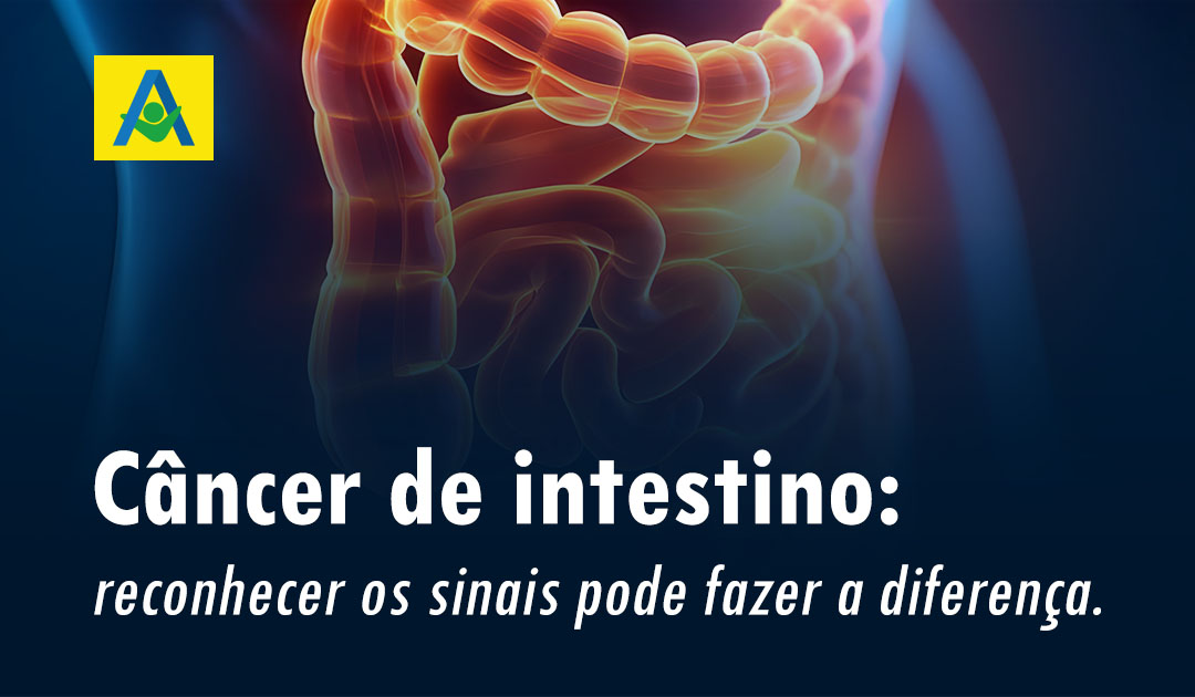 24.07 – Câncer de intestino – Blog
